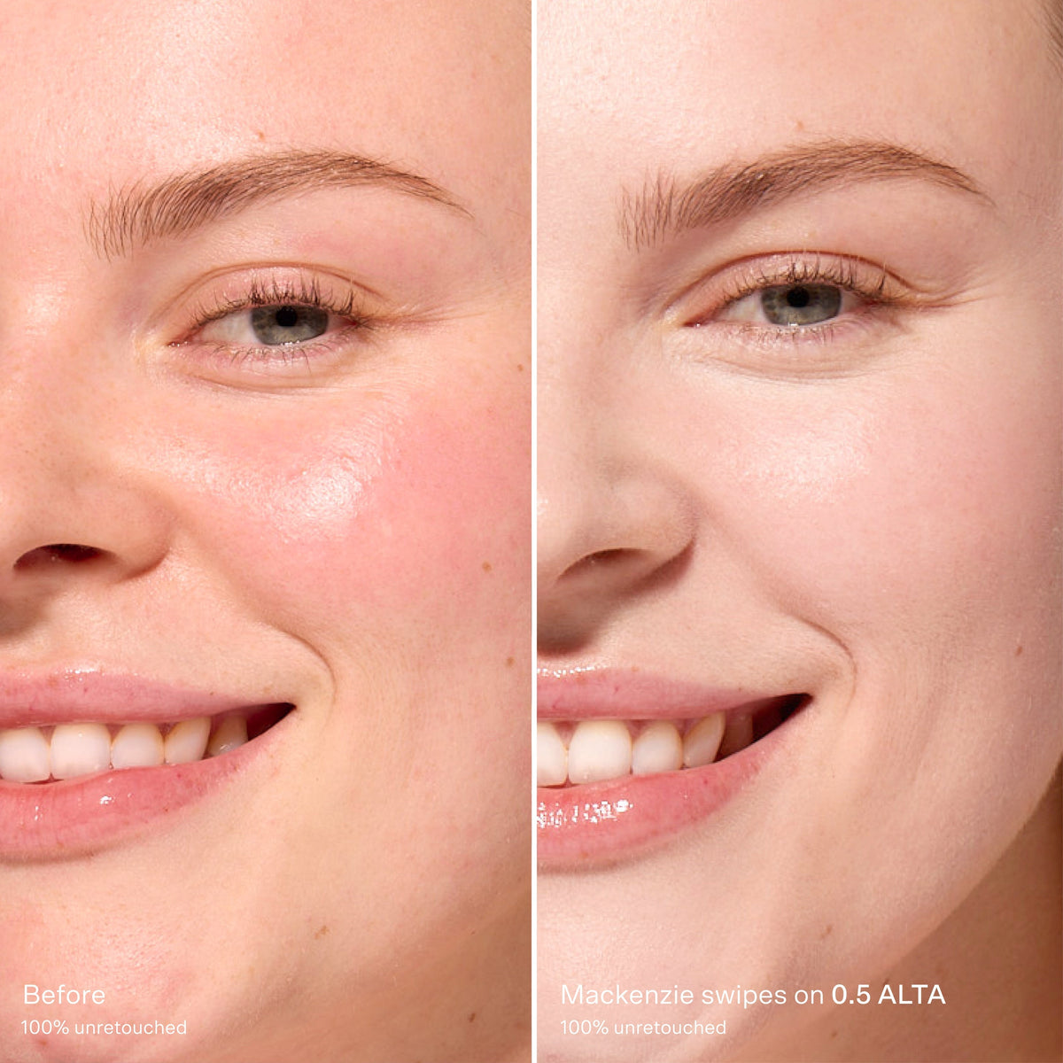 Swipe Serum Concealer® X8