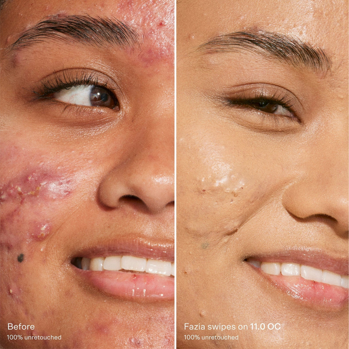 Swipe Serum Concealer® U4