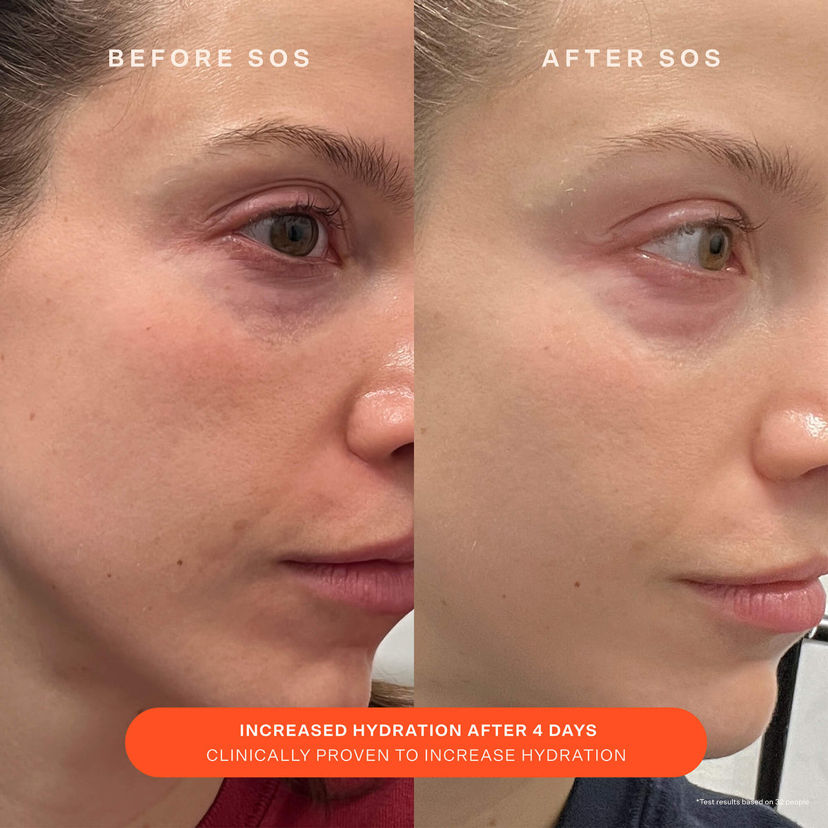 SOS Recovery Cream E0