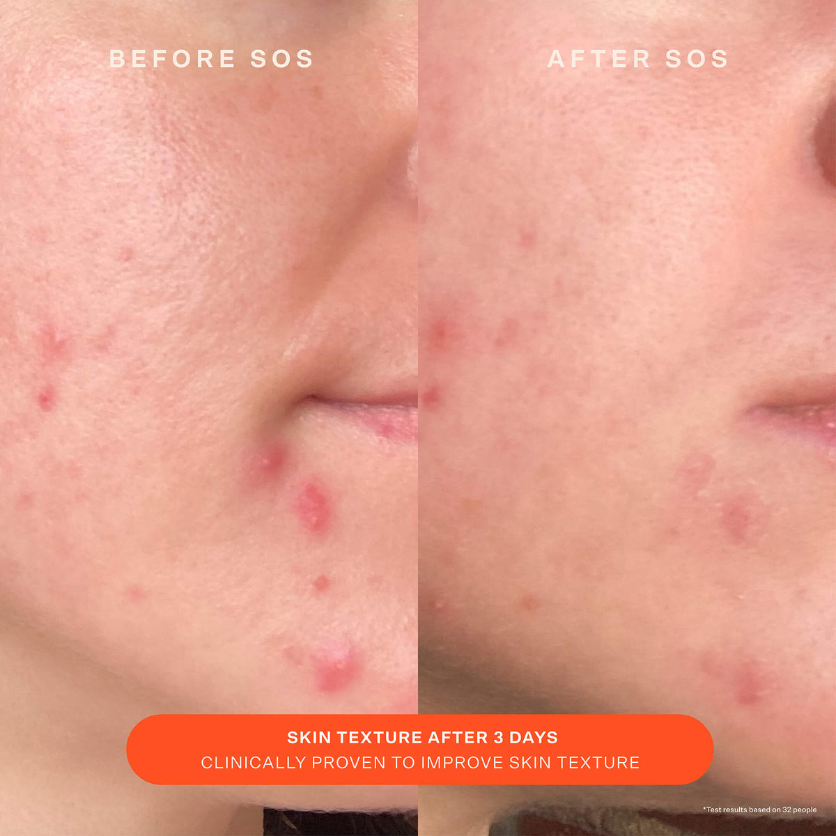SOS Recovery Cream E0