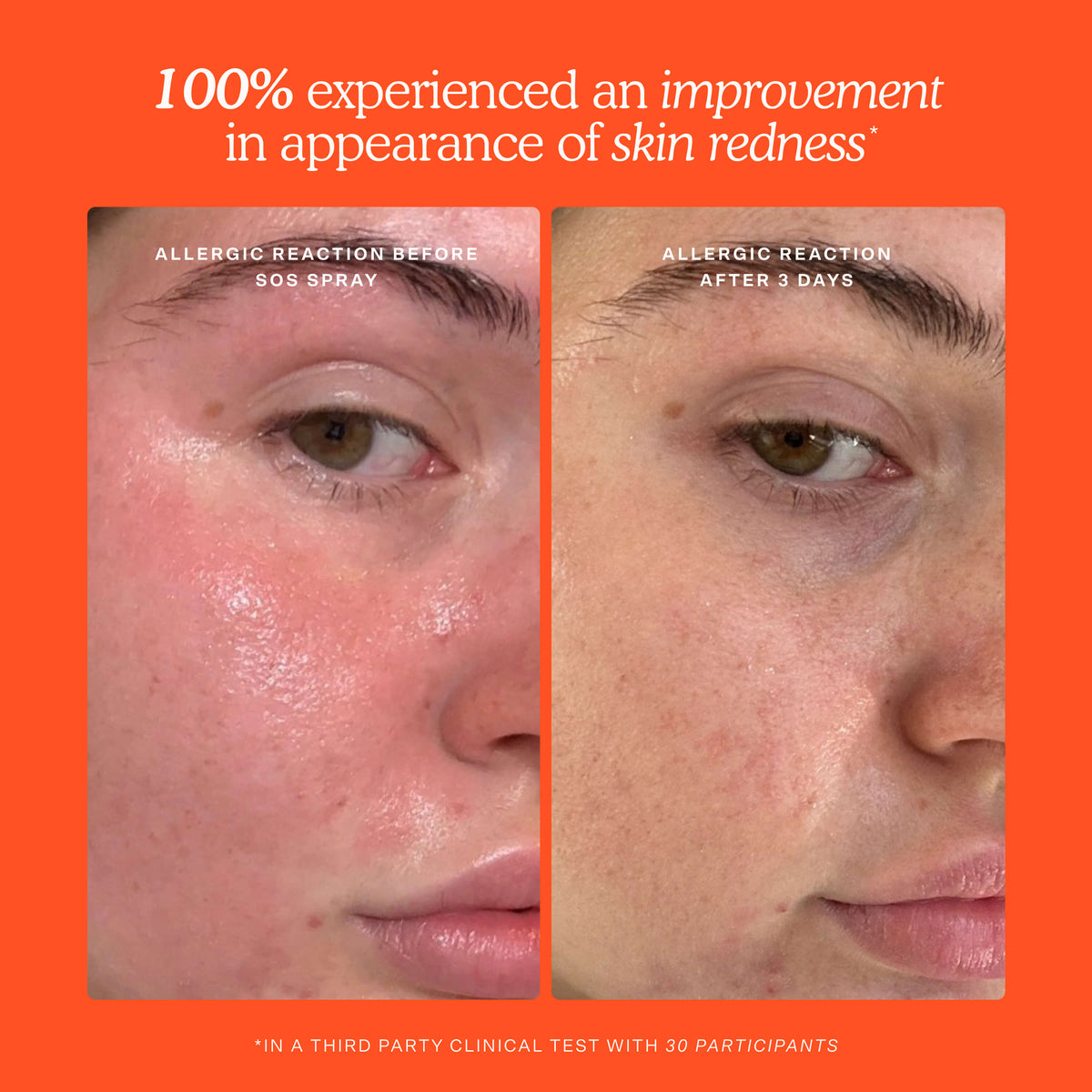 SOS Skincare Minis Kit H4