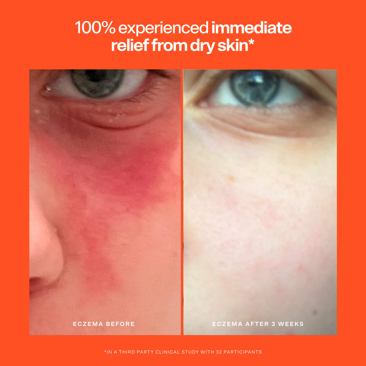 SOS Rescue Serum F3