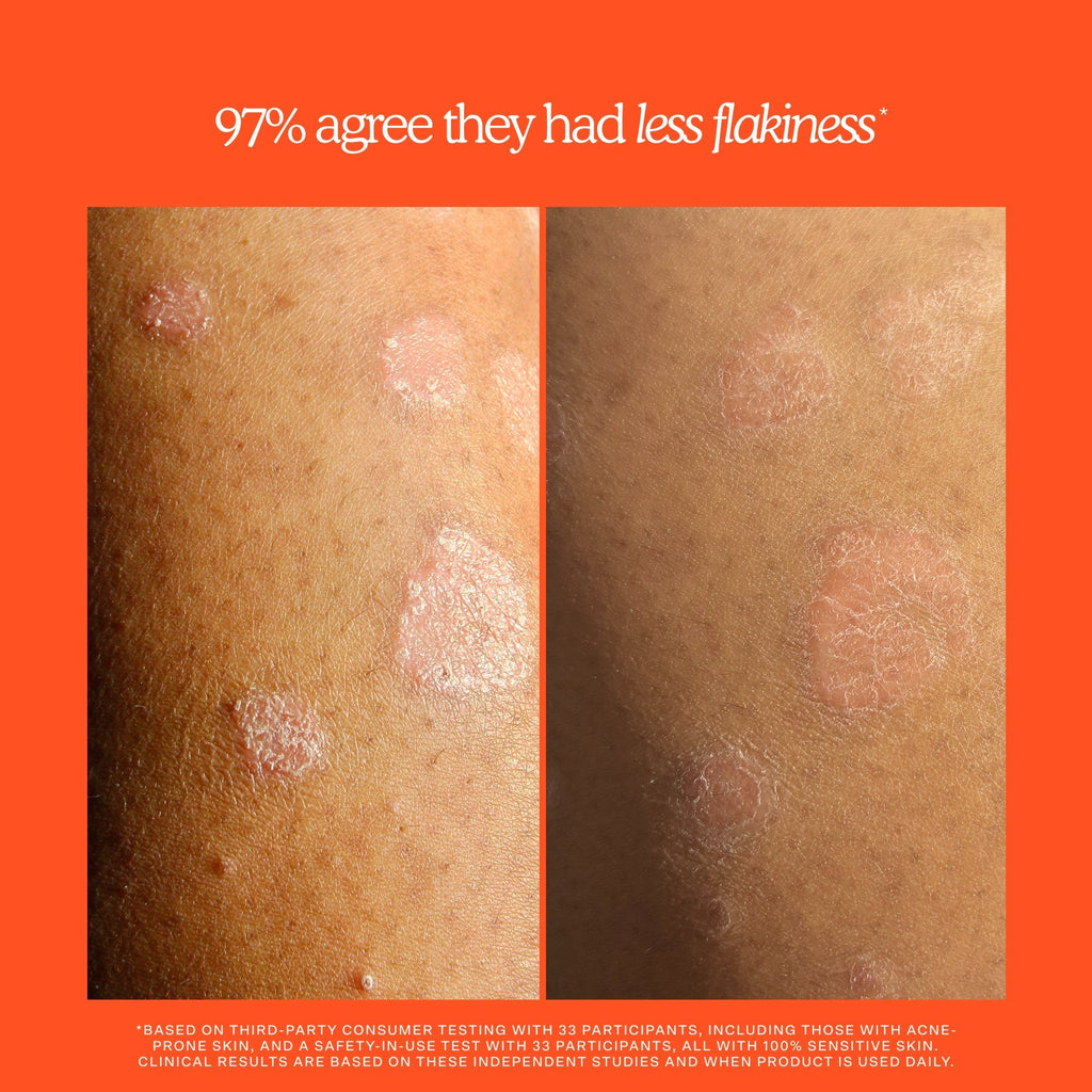 SOS Rescue + Relief Body Wash Treatment B0