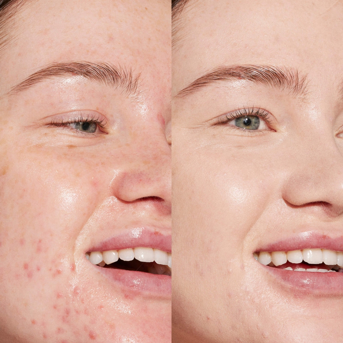 Swipe Serum Concealer® U4